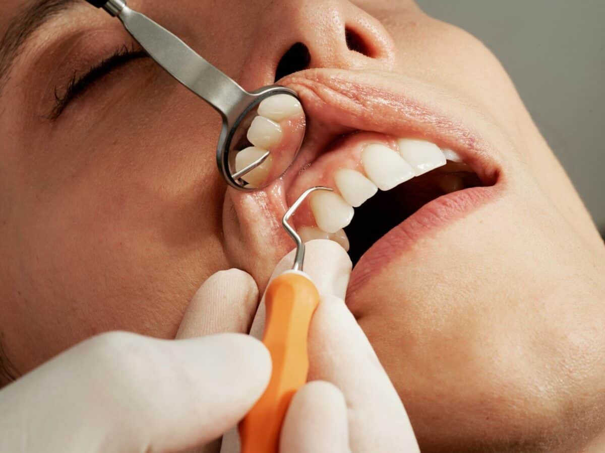 ¿Cuándo es el mejor momento para colocarse un implante dental?